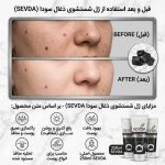مزایای استفاده از فوم شستشوی زغال فعال سودا