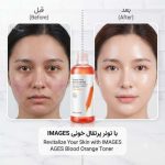قبل وبعد استفاده از تونر آبرسان پرتقال خونی ایمیجز